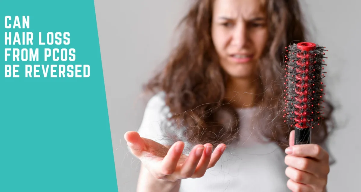 Can Hair Loss From PCOS Be Reversed? What the Experts Say