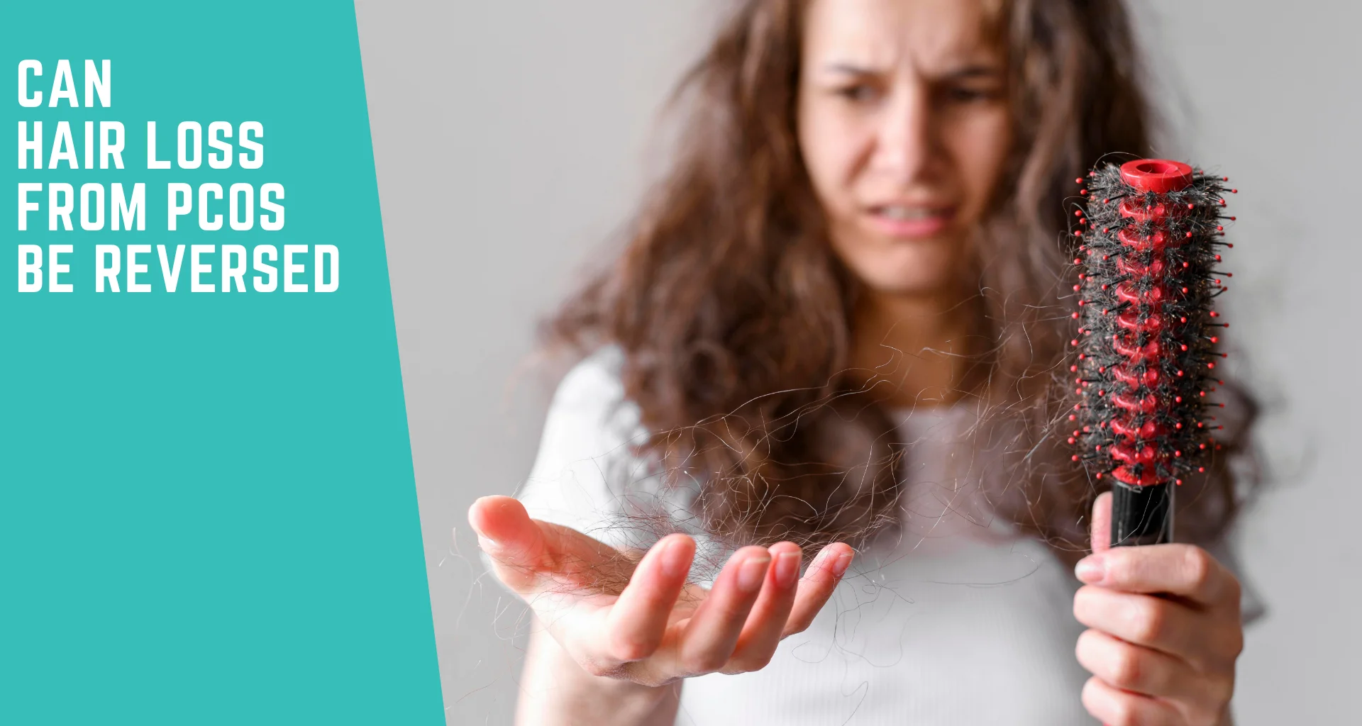 Can Hair Loss From PCOS Be Reversed? What the Experts Say