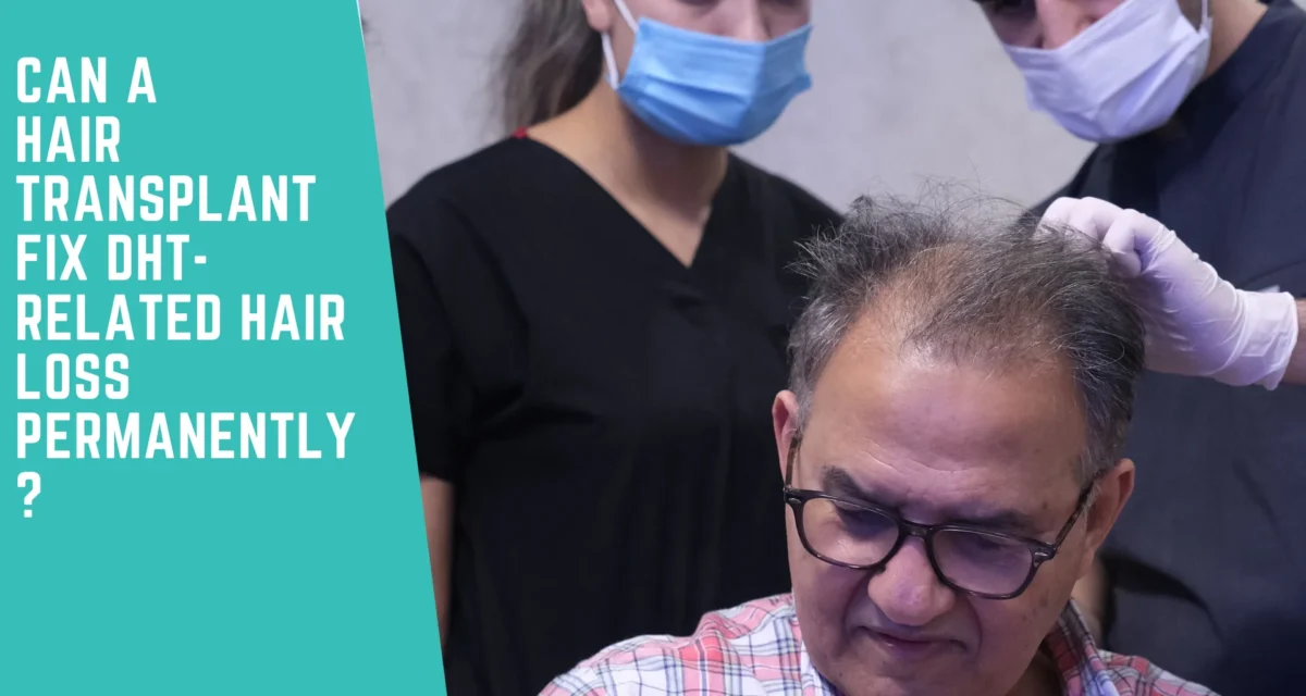 Can a Hair Transplant Fix DHT Hair Loss Permanently?