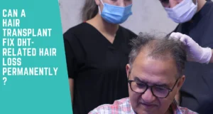 DHT hair loss