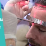 How Many Hair Transplants Does UniquEra Perform Per Day?