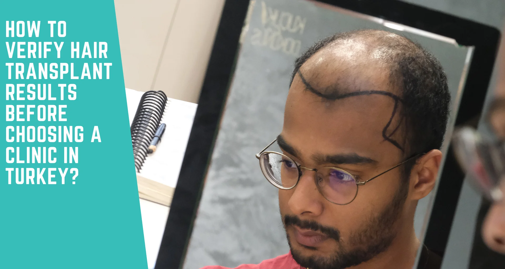 How to Verify Hair Transplant Results Before Choosing a Clinic in Turkey?