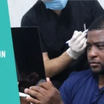 best hair transplant clinic in Istanbul