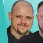 FUE Hair Transplant: How It Works