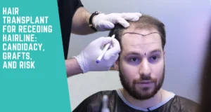Hair Transplant for Receding Hairline: Candidacy, Grafts, and Risk 3 Hair Transplant for Receding Hairline: Candidacy, Grafts, and Risk
