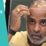 How UniquEra clinic Assess Long-Term Hair Loss Before Surgery