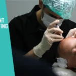 How does UniquEra clinic Prevent Overharvesting During Hair Transplant Surgery