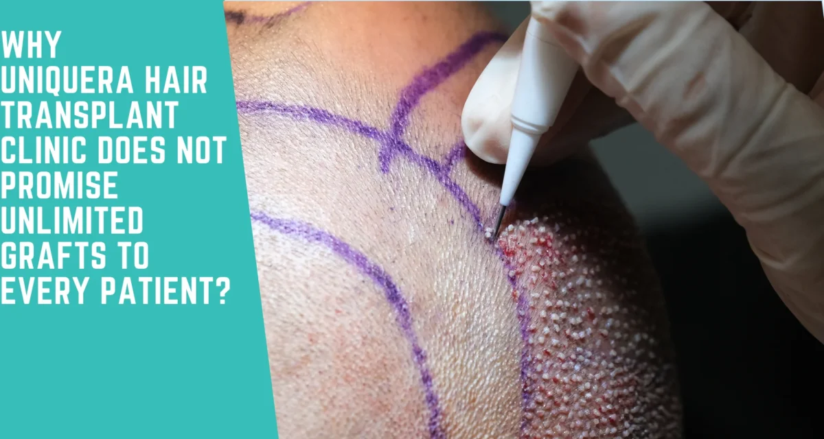 Why UniquEra Hair Transplant Clinic Does Not Promise Unlimited Grafts to Every Patient