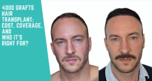 4000 Grafts Hair Transplant: Cost, Coverage, and Who It’s Right For