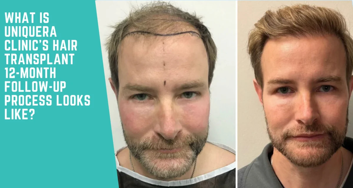 What UniquEra Clinic’s 12-Month Hair Transplant Follow-Up Process Looks Like