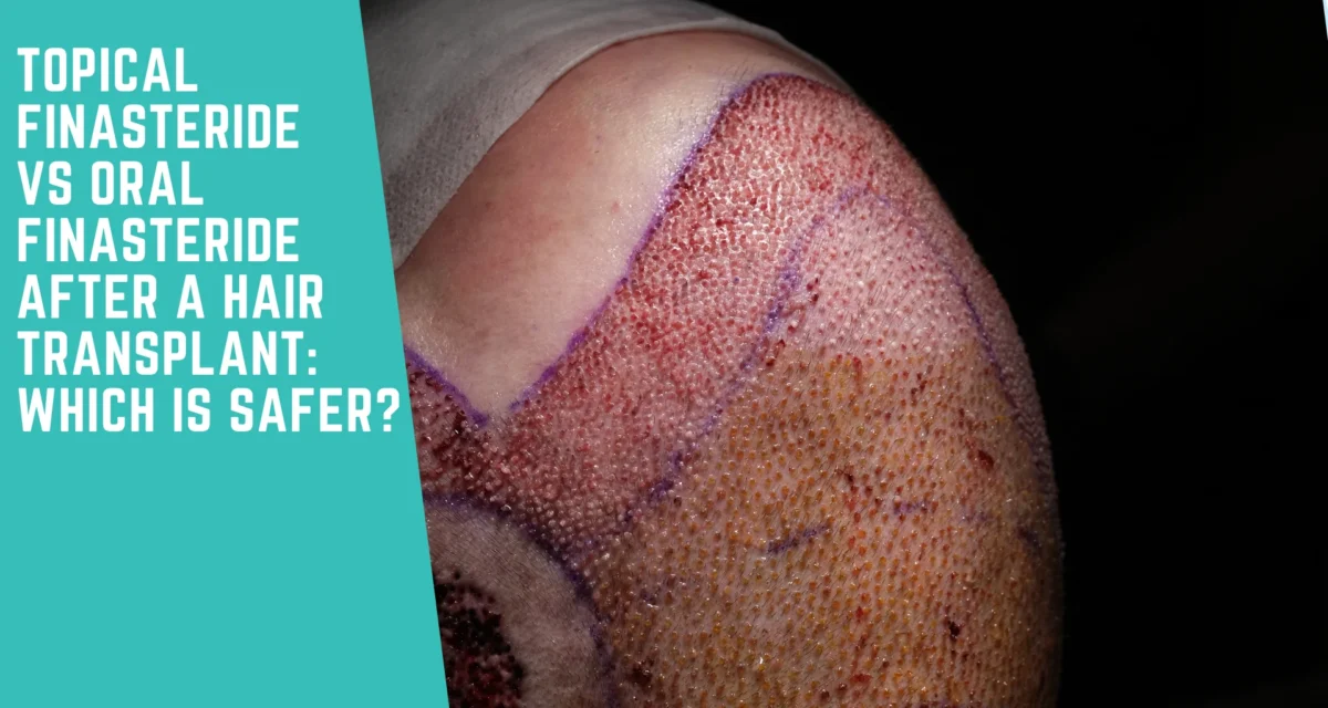 Topical Finasteride vs Oral Finasteride After a Hair Transplant: Which Is Safer?